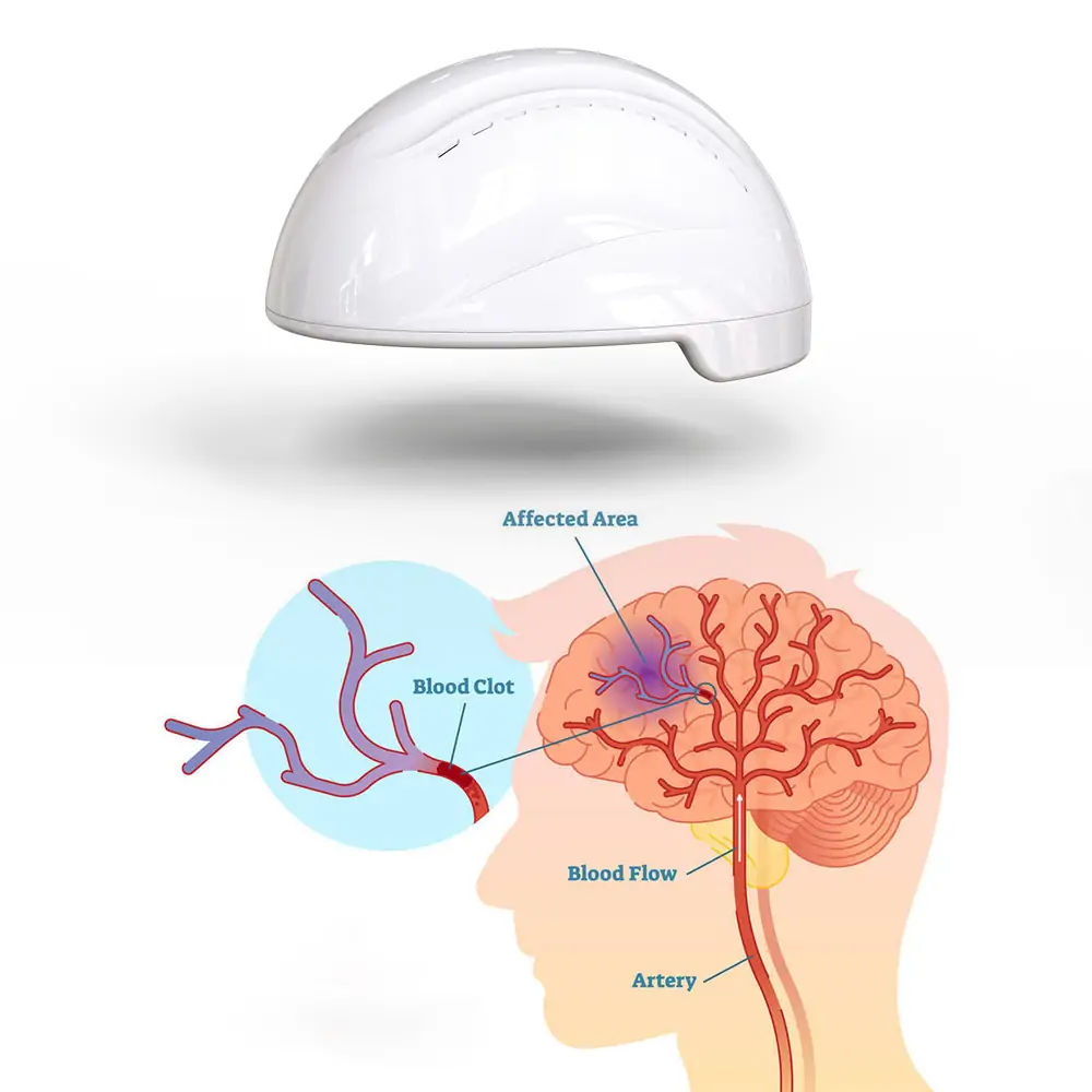 Brain Photobiomodulation Helmet